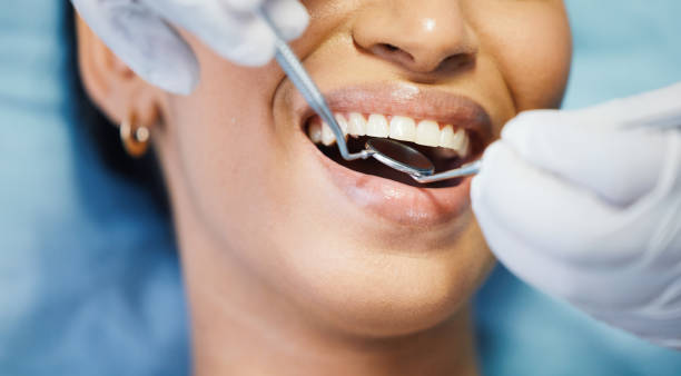 Best Emergency Dentist for Lost Fillings or Crowns in Clarksville, IN